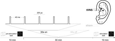 Transcutaneous Vagus Nerve Stimulation (tVNS) and the Dynamics of Visual Bistable Perception